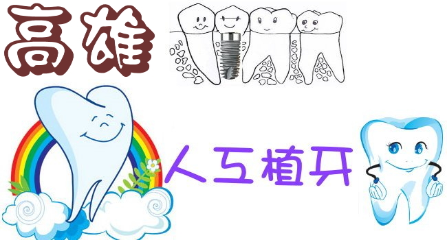 嘉義牙醫診所 植牙前必知的12件事情 價格 費用 推薦 奇奇筆記